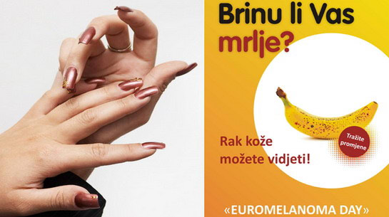  Manikura može izazvati zloćudne promjene na koži