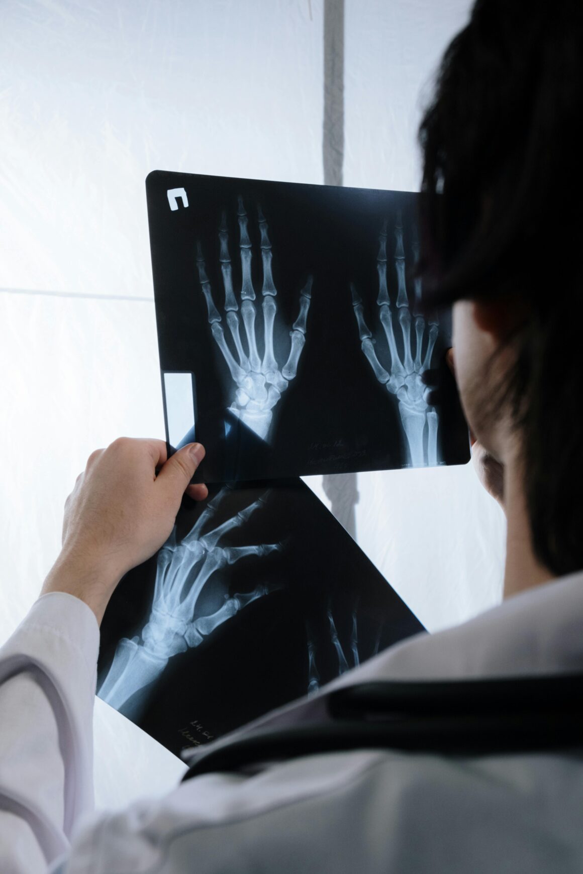 Preskakanje doručka i kasne večere povećavaju rizik od osteoporoze i prijeloma. Saznaj zašto je vrijeme obroka presudno za zdravlje kostiju.