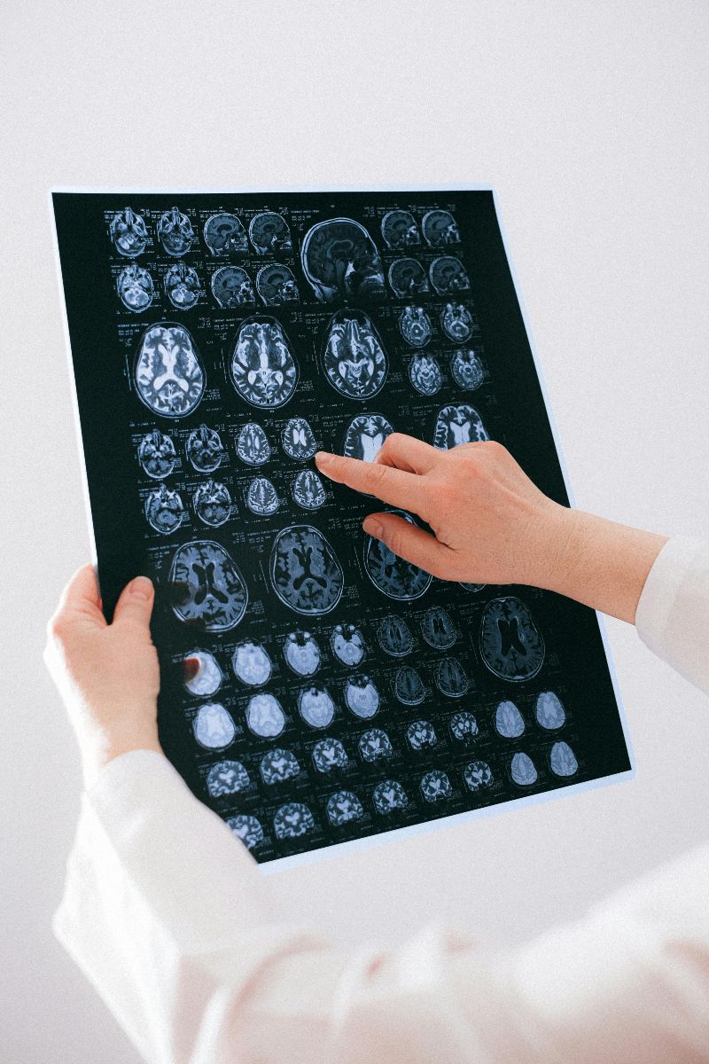 Trauma iz djetinjstva može ostaviti dugotrajan trag, a novo istraživanje pokazuje kako tjelesna aktivnost može pomoći mozgu